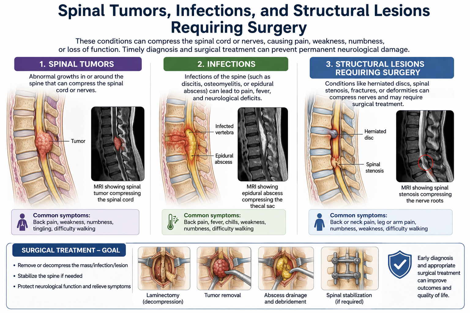 Spinal Tumors, Infections, and Structural Lesions Requiring Surgery