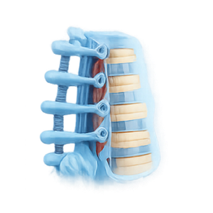 Spine Fixation & Decompression