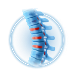 Minimally Invasive Spine Surgery
